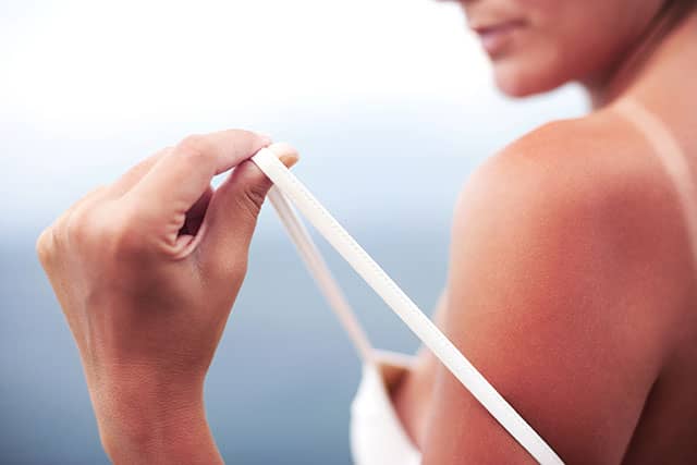 The Impact of Sun on Your Skin